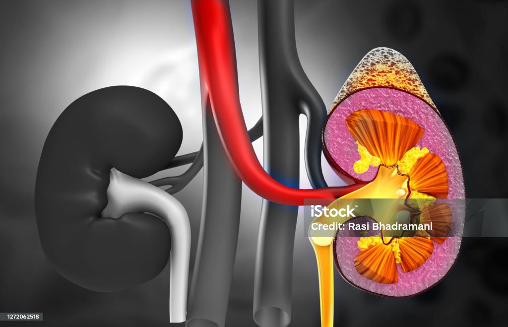 Major symptoms of kidney failure